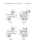 Intervertebral disc replacement prosthesis diagram and image