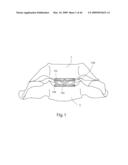 Systems and Methods for Vertebral Disc Replacement diagram and image