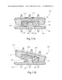 Systems and Methods for Vertebral Disc Replacement diagram and image