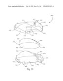 Systems and Methods for Vertebral Disc Replacement diagram and image