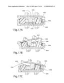 Systems and Methods for Vertebral Disc Replacement diagram and image