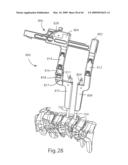 Systems and Methods for Vertebral Disc Replacement diagram and image
