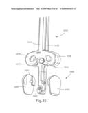 Systems and Methods for Vertebral Disc Replacement diagram and image