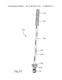 Systems and Methods for Vertebral Disc Replacement diagram and image