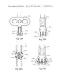 Systems and Methods for Vertebral Disc Replacement diagram and image