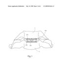 Systems and Methods for Vertebral Disc Replacement diagram and image