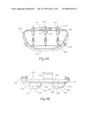 Systems and Methods for Vertebral Disc Replacement diagram and image