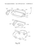 Systems and Methods for Vertebral Disc Replacement diagram and image