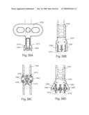 Systems and Methods for Vertebral Disc Replacement diagram and image