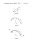 Implantable Obstructive Sleep Apnea Sensor diagram and image