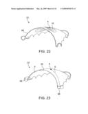 Implantable Obstructive Sleep Apnea Sensor diagram and image