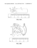 Implantable Obstructive Sleep Apnea Sensor diagram and image