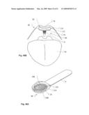 Implantable Obstructive Sleep Apnea Sensor diagram and image