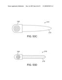 Implantable Obstructive Sleep Apnea Sensor diagram and image