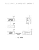 Implantable Obstructive Sleep Apnea Sensor diagram and image