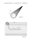 DRILLING SUBSURFACE WELLBORES WITH CUTTING STRUCTURES diagram and image