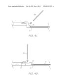 ELECTRONIC COMPONENT WITH WIRE BONDS IN LOW MODULUS FILL ENCAPSULANT diagram and image