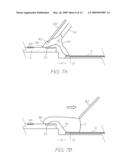 ELECTRONIC COMPONENT WITH WIRE BONDS IN LOW MODULUS FILL ENCAPSULANT diagram and image