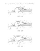 ELECTRONIC COMPONENT WITH WIRE BONDS IN LOW MODULUS FILL ENCAPSULANT diagram and image