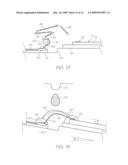 ELECTRONIC COMPONENT WITH WIRE BONDS IN LOW MODULUS FILL ENCAPSULANT diagram and image