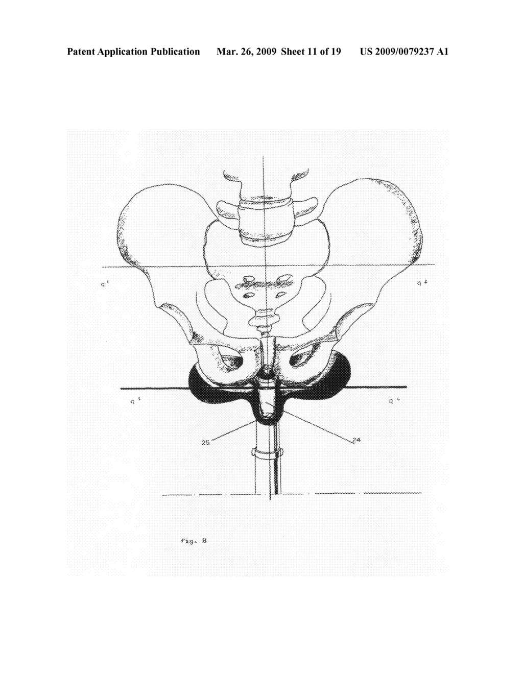 Bicycle Saddle - diagram, schematic, and image 12