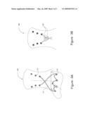 CRISS-CROSS HARNESS SYSTEM FOR USE WITH SEATS diagram and image