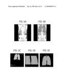 METHOD TO DETECT THE AORTIC ARCH IN CT DATASETS FOR DEFINING A HEART WINDOW diagram and image