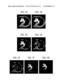 METHOD TO DETECT THE AORTIC ARCH IN CT DATASETS FOR DEFINING A HEART WINDOW diagram and image