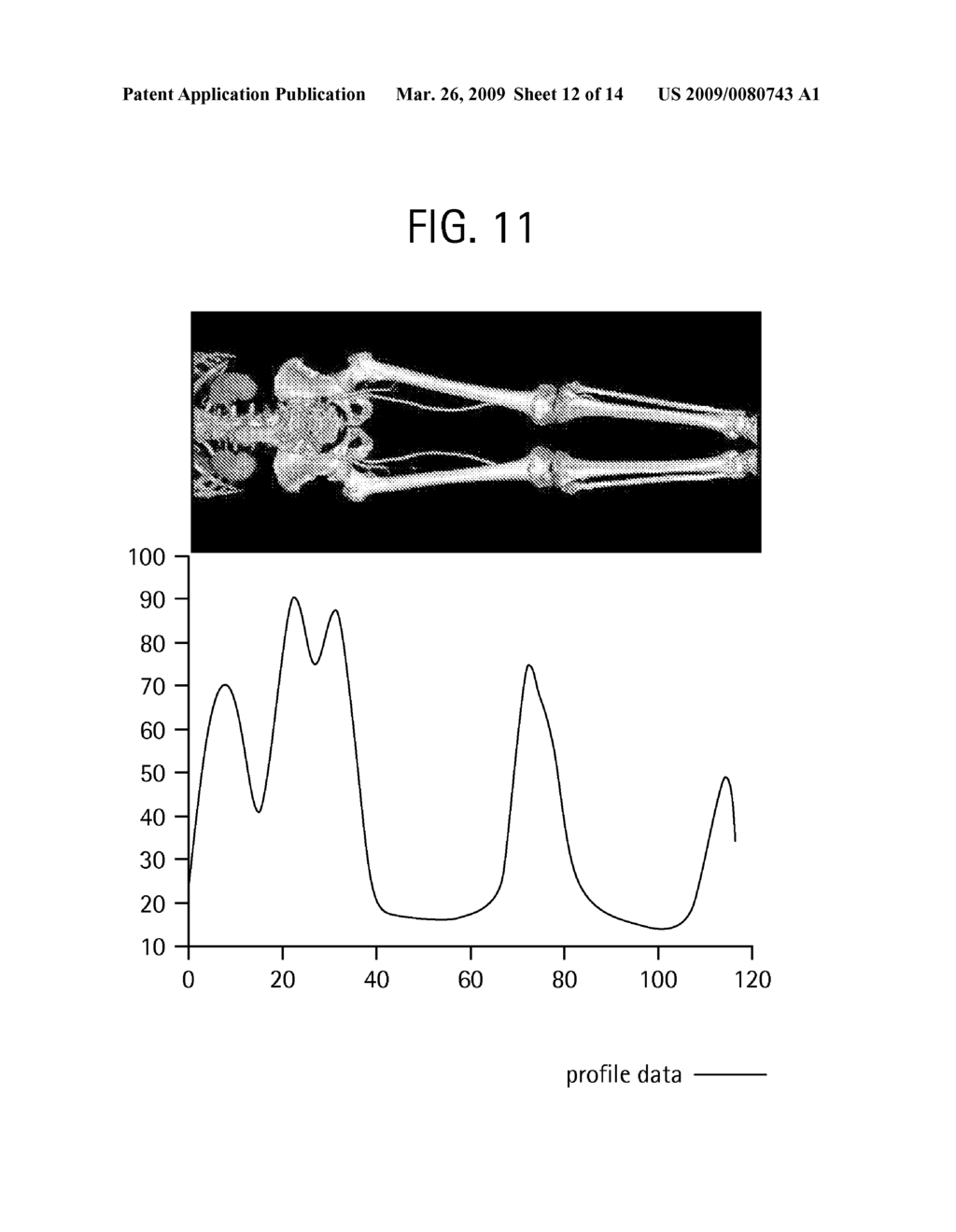 METHOD TO DETECT THE AORTIC ARCH IN CT DATASETS FOR DEFINING A HEART WINDOW - diagram, schematic, and image 13