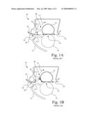 Belt Fuser Assembly Having Feature To Prevent Media Wrapping Of The Fuser Belt diagram and image