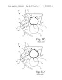 Belt Fuser Assembly Having Feature To Prevent Media Wrapping Of The Fuser Belt diagram and image