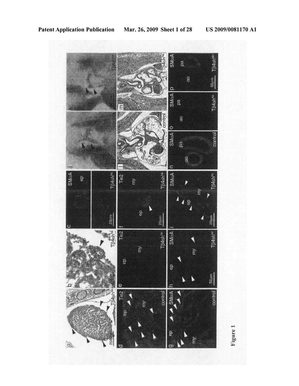 Cardiac progenitor cells - diagram, schematic, and image 02