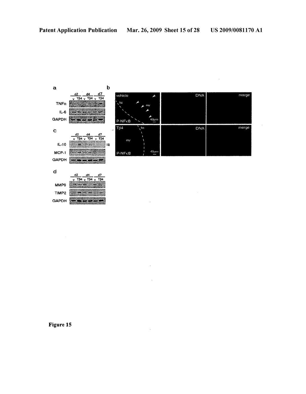 Cardiac progenitor cells - diagram, schematic, and image 16