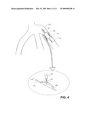 SUSTAINED RELEASE OF APO A-I MIMETIC PEPTIDES AND METHODS OF TREATMENT diagram and image