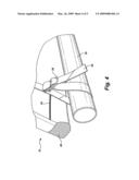 Bucking chute safety pad diagram and image