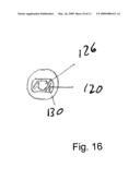 IMPLANT ANALOG diagram and image