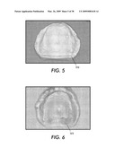 SYSTEM AND METHOD FOR IMMEDIATE LOADING OF FIXED HYBRID DENTAL PROSTHESES diagram and image