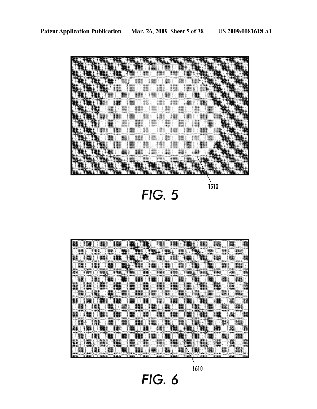 SYSTEM AND METHOD FOR IMMEDIATE LOADING OF FIXED HYBRID DENTAL PROSTHESES - diagram, schematic, and image 06