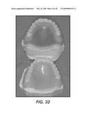 SYSTEM AND METHOD FOR IMMEDIATE LOADING OF FIXED HYBRID DENTAL PROSTHESES diagram and image