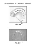 SYSTEM AND METHOD FOR IMMEDIATE LOADING OF FIXED HYBRID DENTAL PROSTHESES diagram and image