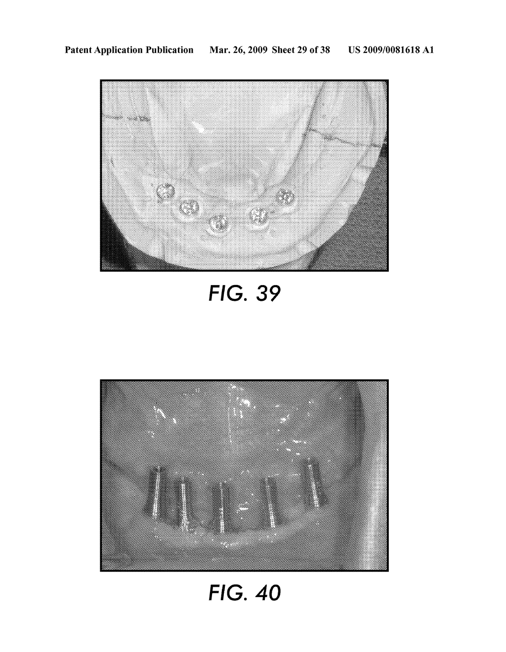 SYSTEM AND METHOD FOR IMMEDIATE LOADING OF FIXED HYBRID DENTAL PROSTHESES - diagram, schematic, and image 30