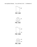 SYSTEM AND METHOD FOR IMMEDIATE LOADING OF FIXED HYBRID DENTAL PROSTHESES diagram and image