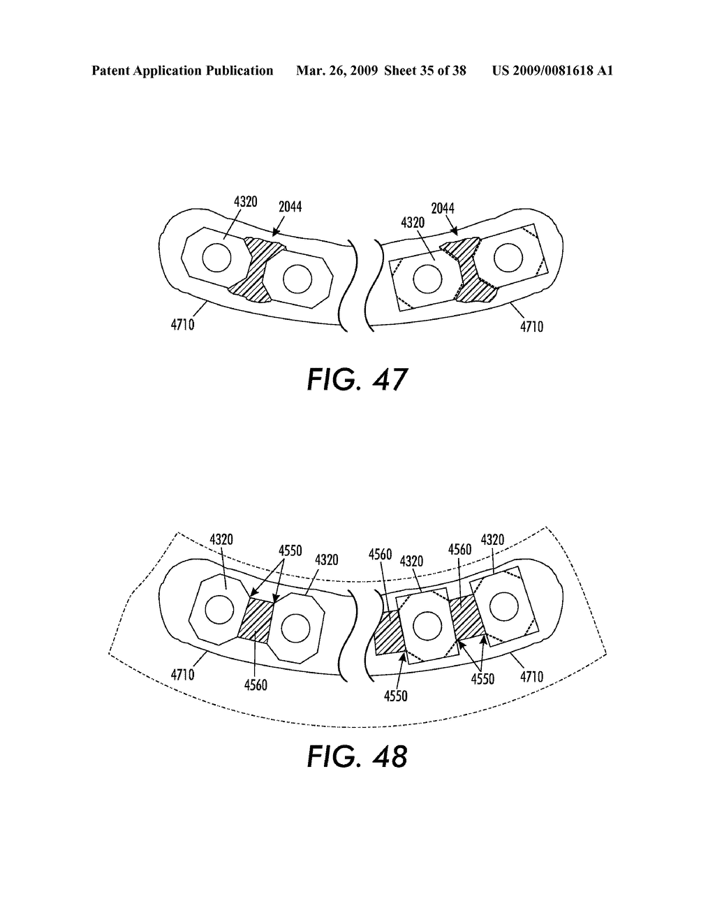 SYSTEM AND METHOD FOR IMMEDIATE LOADING OF FIXED HYBRID DENTAL PROSTHESES - diagram, schematic, and image 36