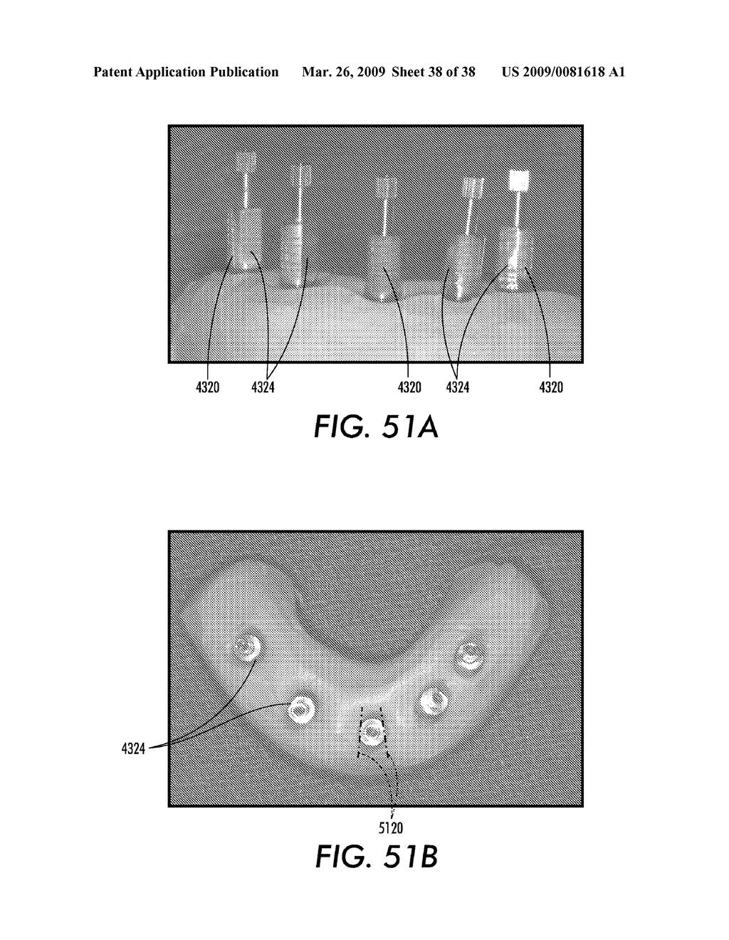 SYSTEM AND METHOD FOR IMMEDIATE LOADING OF FIXED HYBRID DENTAL PROSTHESES - diagram, schematic, and image 39