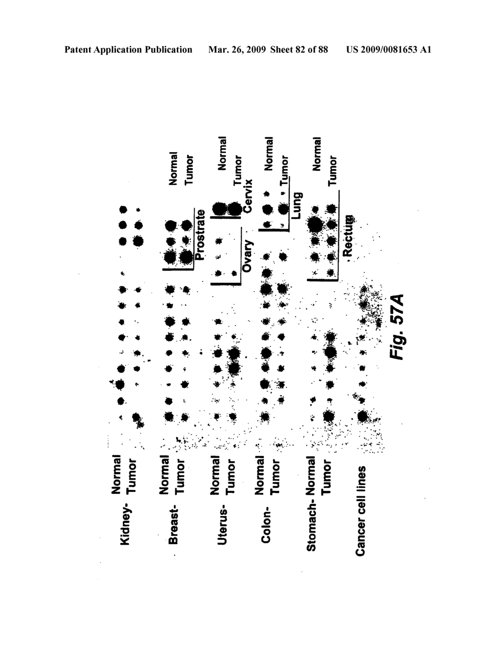 Insulin-responsive DNA binding proteins-1 and methods to regulate insulin-responsive genes - diagram, schematic, and image 83