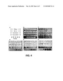 Mutations in Ion Channels diagram and image