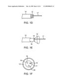 Visualization and treatment via percutaneous methods and devices diagram and image