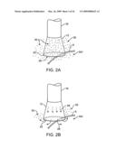 Visualization and treatment via percutaneous methods and devices diagram and image