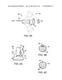 Visualization and treatment via percutaneous methods and devices diagram and image