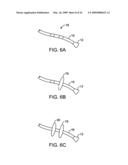 Visualization and treatment via percutaneous methods and devices diagram and image